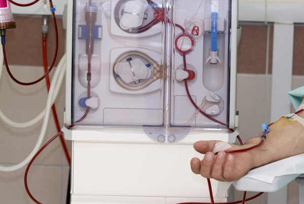 Dialysis Technology